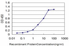 Monoclonal Mouse anti-Human FGR Antibody (clone 3B11, IHC, WB)