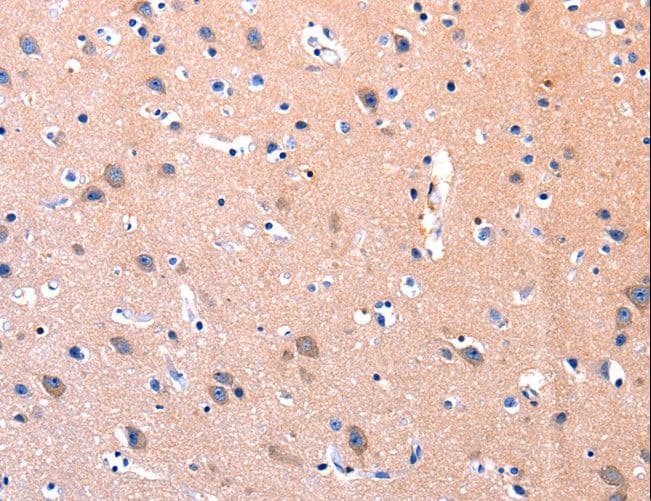 Polyclonal Rabbit anti-Human FAK / Focal Adhesion Kinase Antibody (IHC, WB)