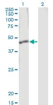 Monoclonal Mouse anti-Human SERPINB1 Antibody (clone 4A7, WB)