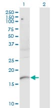 PLXNA2 / Plexin A2 Antibody (clone 2G5)