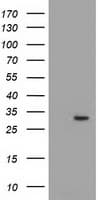 P5CR2 / PYCR2 Antibody (clone OTI3D1)