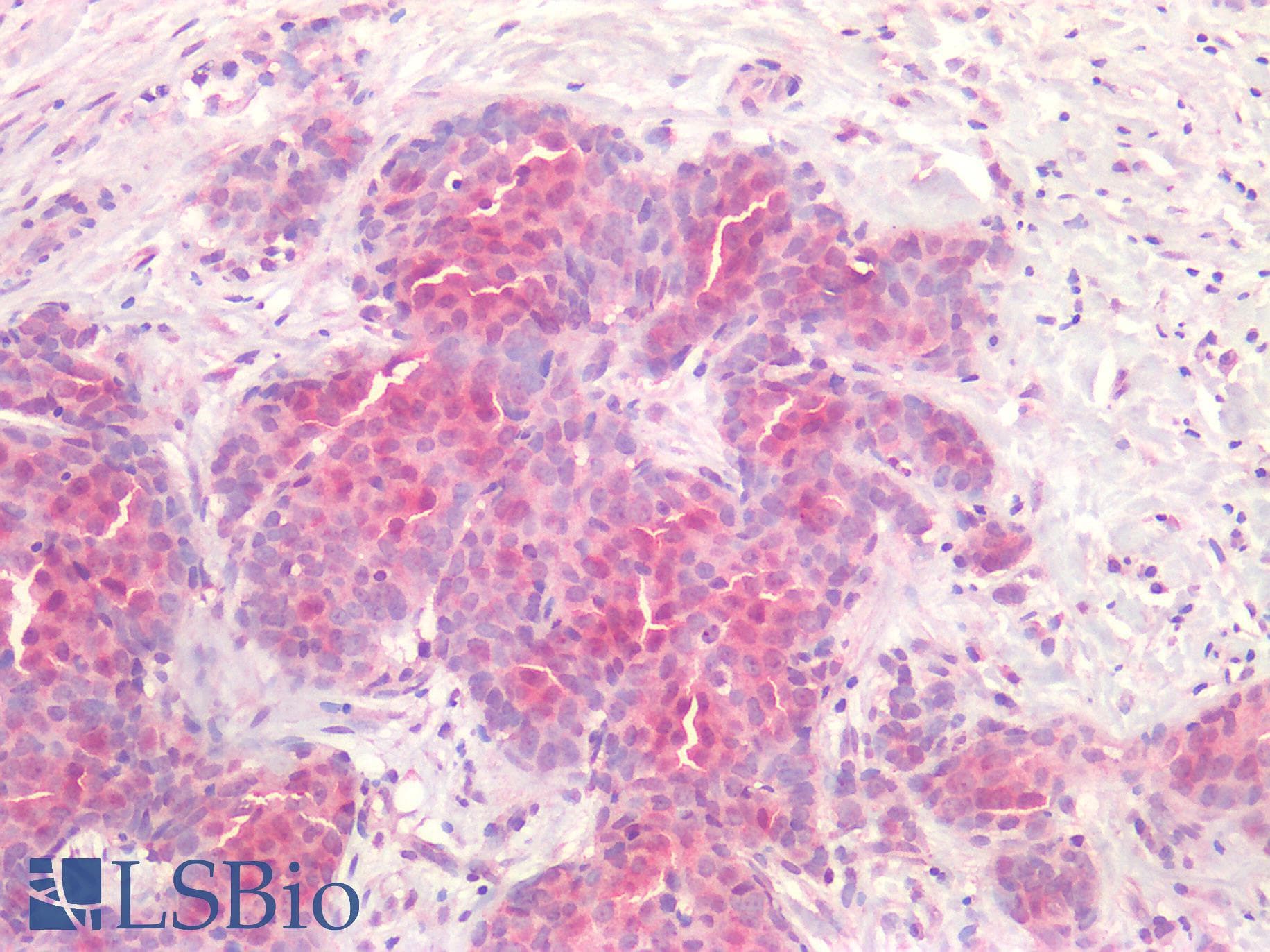 IHC-plus™ FZD7 / Frizzled 7 Antibody (N-Terminus)