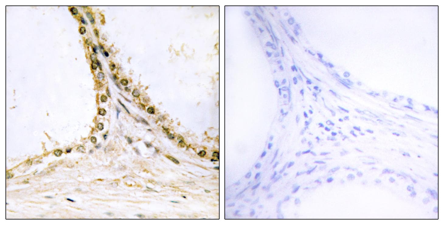 VAV1 / VAV Antibody (phospho-Tyr160)