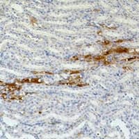 Monoclonal Mouse anti-Human FN1 / Fibronectin Antibody (IHC, WB)