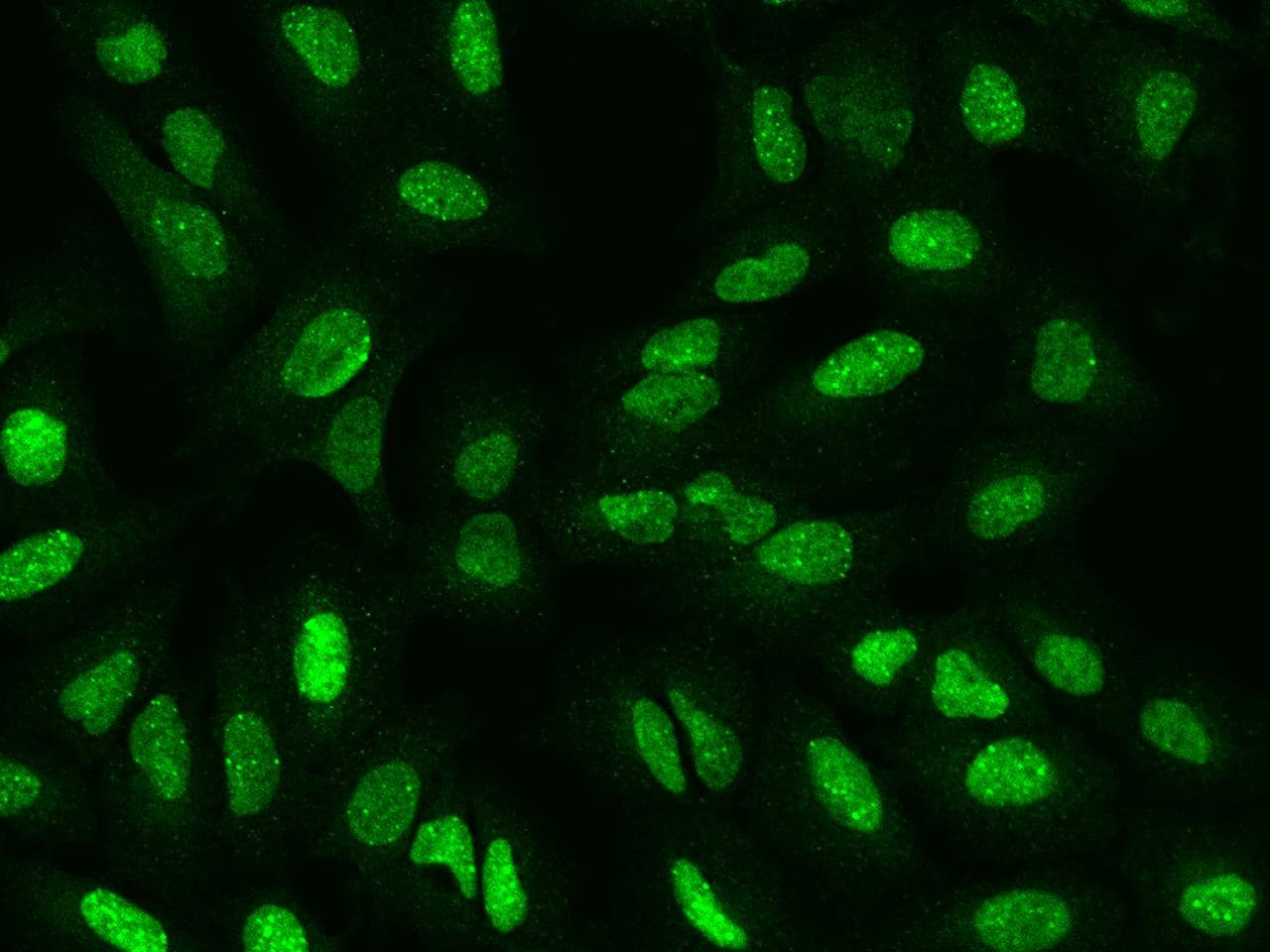 SP100 Antibody