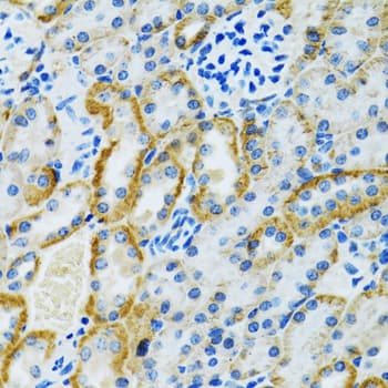 Polyclonal Rabbit anti-Human GDAP1 Antibody (IHC, WB)
