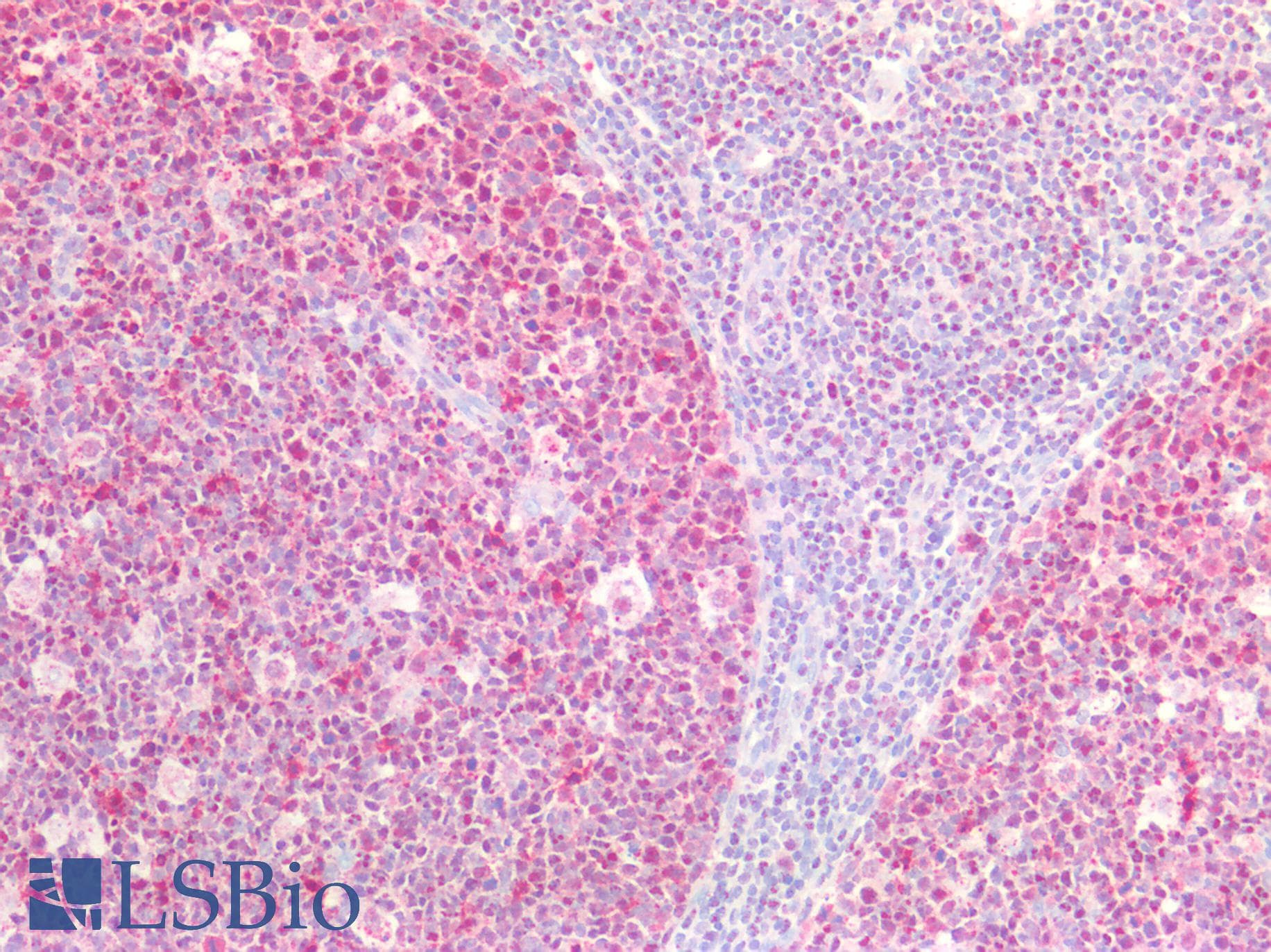 IHC-plus™ BCL2 / Bcl-2 Antibody