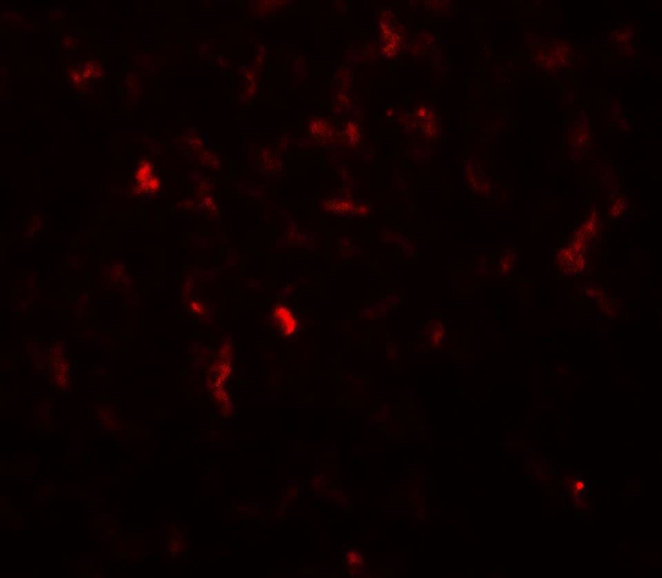 IHC-plus™ Polyclonal Rabbit anti-Human HK1 / Hexokinase 1 Antibody (IHC, IF, WB)