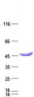 Human IDH1 / IDH Protein (Recombinant DDK,C-terminus)