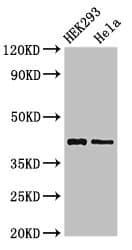 GALK1 / GK1 Antibody