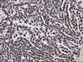 FBXO21 Antibody (clone OTI6E7, Carrier-free)