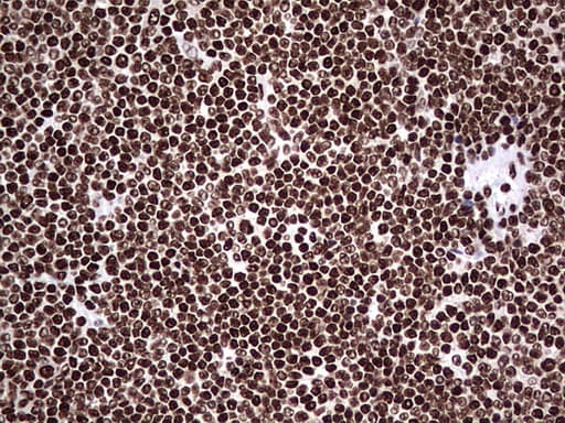HNRNPL / hnRNP L Antibody (aa270-502, clone OTI9F11)