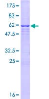 Human UTP15 Protein (Recombinant GST)