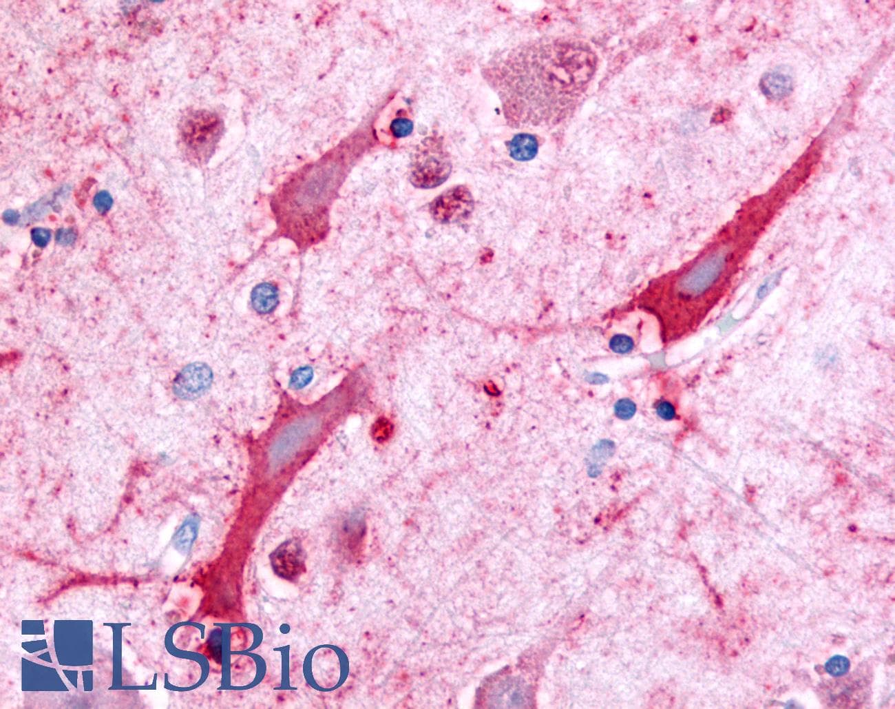IHC-plus™ Ceramide Kinase / CERK Antibody (N-Terminus)