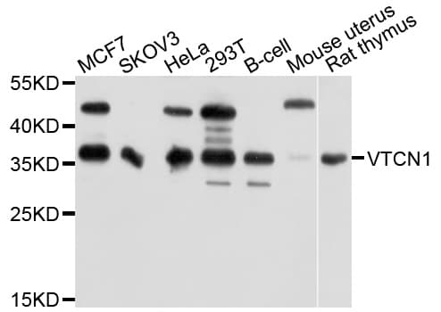 VTCN1 / B7-H4 Antibody