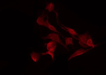 Polyclonal Rabbit anti-Human FOS / c-FOS Antibody (phospho-Ser362, IHC, IF, WB)
