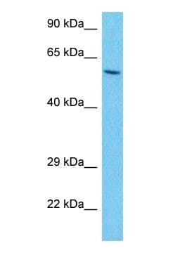 PFK2 / PFKFB3 Antibody (C-Terminus)