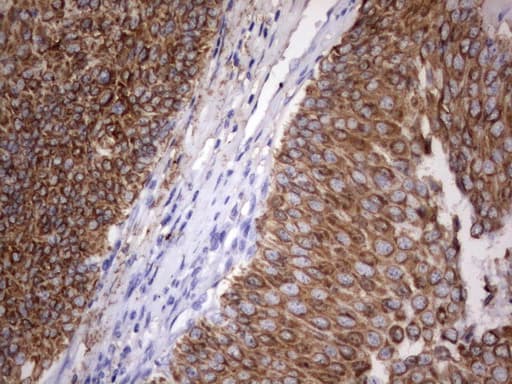 Monoclonal Rat anti-Human Acidic Cytokeratin Antibody (clone 2G10, IHC)