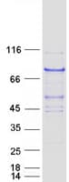 Human DCAF8 / WDR42A Protein (Recombinant Myc-DDK (Flag))