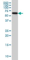 DPH2 Antibody (clone 5B10)