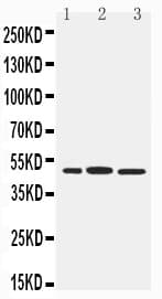 ICSBP / IRF8 Antibody (aa411-426)