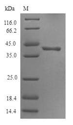 Human HTR3D / 5HT3D Receptor Protein (Recombinant 6His-SUMO, N-terminus)