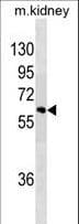 Monoclonal Mouse anti-Human SPRED1 Antibody (WB)