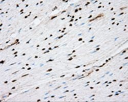 ACSBG1 / hsBG Antibody (clone OTI2B6)