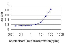 IHC-plus™ ABHD5 Antibody (clone 1F3)