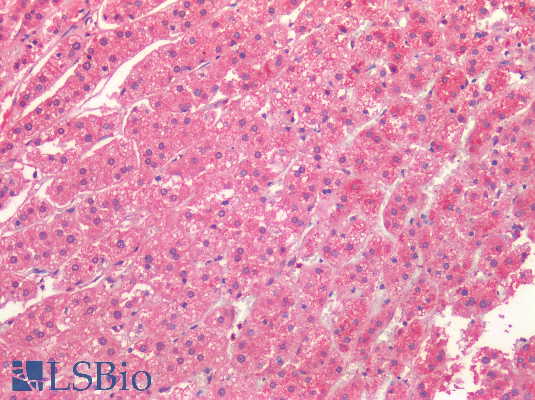 IHC-plus™ Polyclonal Rabbit anti-Human ALK2 / ACVR1 Antibody (IHC)
