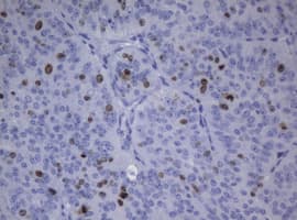 MKI67 / Ki67 Antibody (clone OTI5B10)