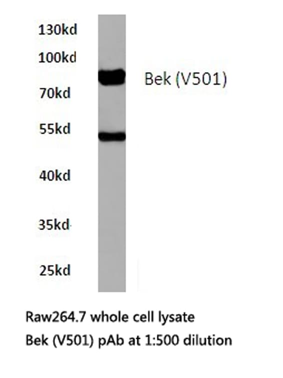FGFR2 / FGF Receptor 2 Antibody (Val501)