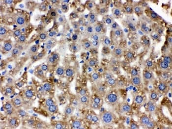 Polyclonal Rabbit anti-Human CAT / Catalase Antibody (IHC, WB)