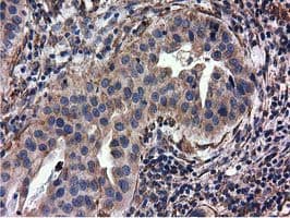 CYB5R3 / B5R Antibody (clone OTI2A10)