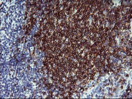 CD22 Antibody (clone OTI4C3, Carrier-free)