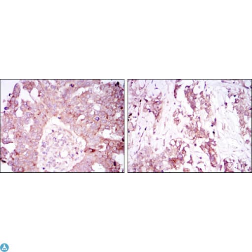 Monoclonal Mouse anti-Human ATXN1 / SCA1 Antibody (IHC, IF, WB)
