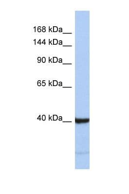 PRDM6 Antibody (C-Terminus)
