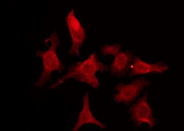 CDH18 / Ey-Cadherin Antibody