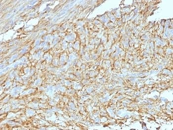 Monoclonal Mouse anti-Human ANO1 / DOG1 / TMEM16A Antibody (clone DG1/447 + DOG-1.1, Azide-free,BSA-free, aa904-986, IHC)