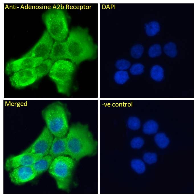 Polyclonal Goat anti-Human ADORA2B/Adenosine A2B Receptor Antibody (aa311-321, IHC, IF)