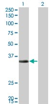 Monoclonal Mouse anti-Human ECH1 Antibody (clone 5G8, WB)