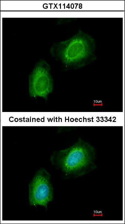 IHC-plus™ GSN / Gelsolin Antibody