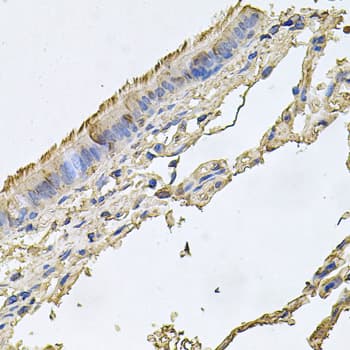 FABP12 Antibody