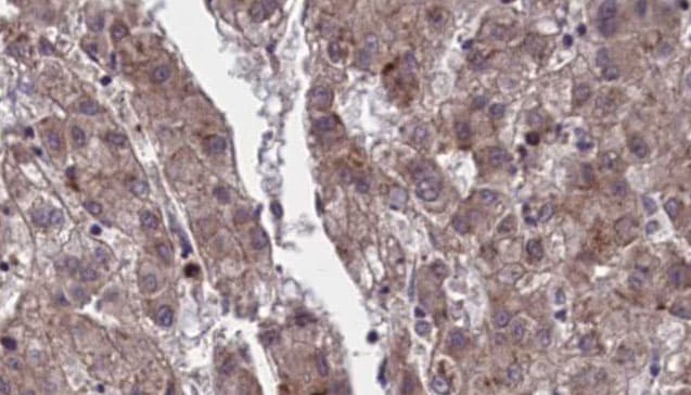 OR4F21 Antibody