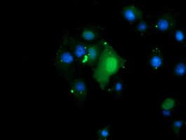 TRMT2A Antibody (clone OTI3D8, Carrier-free)