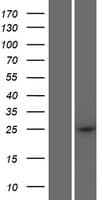 CCDC169 Protein (Over-Expression Lysate Myc-DDK (Flag))