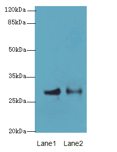 HACD2 / PTPLB Antibody