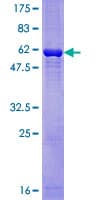 Human GNB2L1 / RACK1 Protein (Recombinant GST)