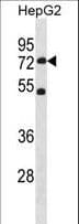 SETD3 Antibody (aa556-585)