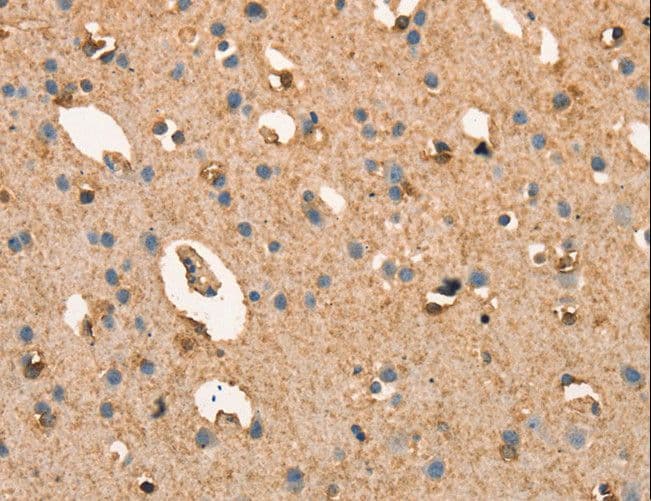 CRELD1 Antibody